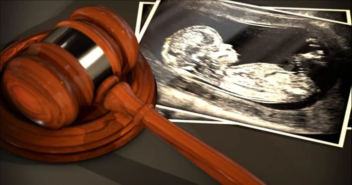 When Is Abortion Actually Allowed?